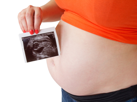 רשלנות רפואית במעקב הריון