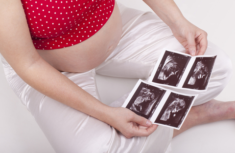 רשלנות רפואית בהריון – הולדה בעוולה
